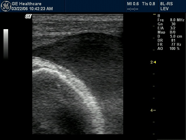 Ultrasound Teaching Cases